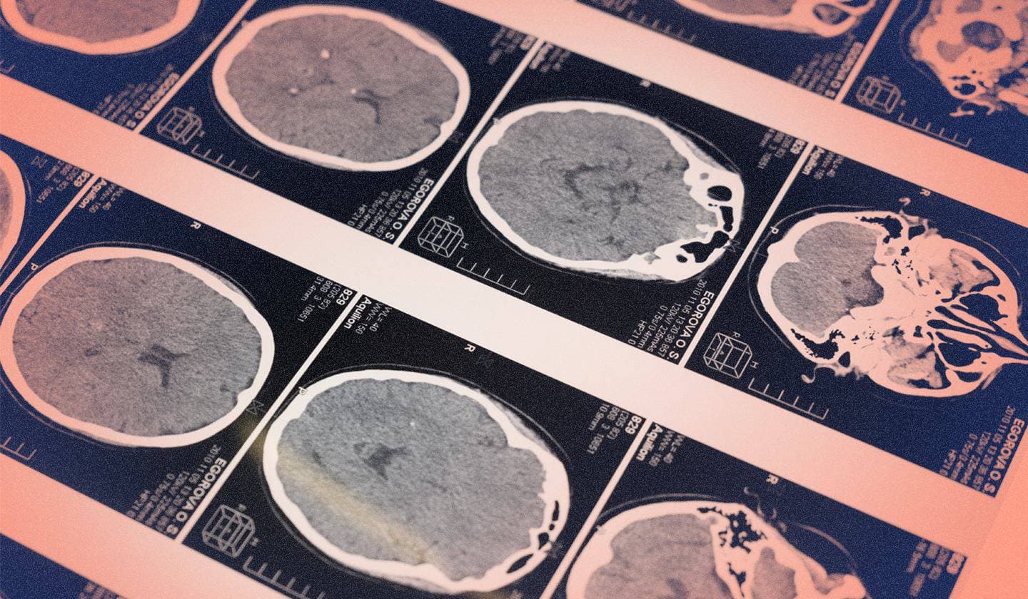 Acelerando o comércio de detecção elástica com LLMs